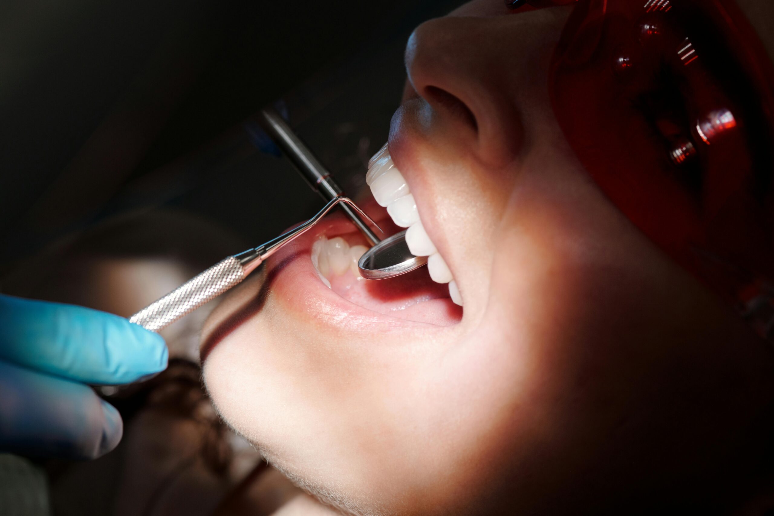 Composite Bonding