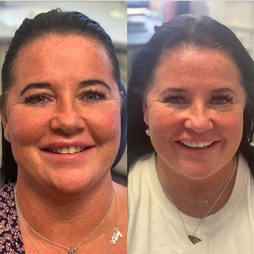 Customers image